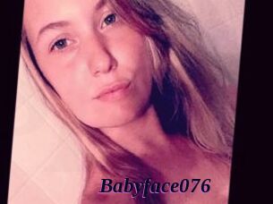Babyface076