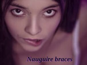 Nauguire_braces