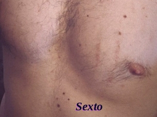 Sexto